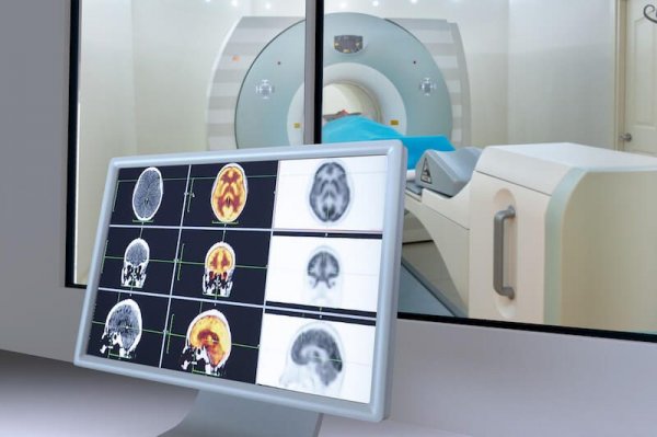 Устройство магнитно-резонансного томографа